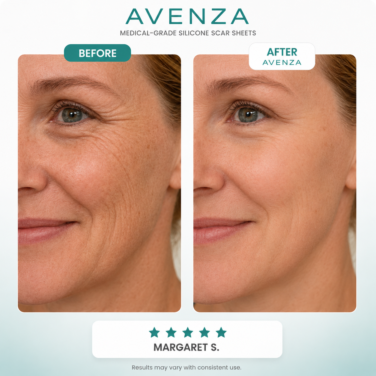 Skinlace™ Smooth Skin Patch