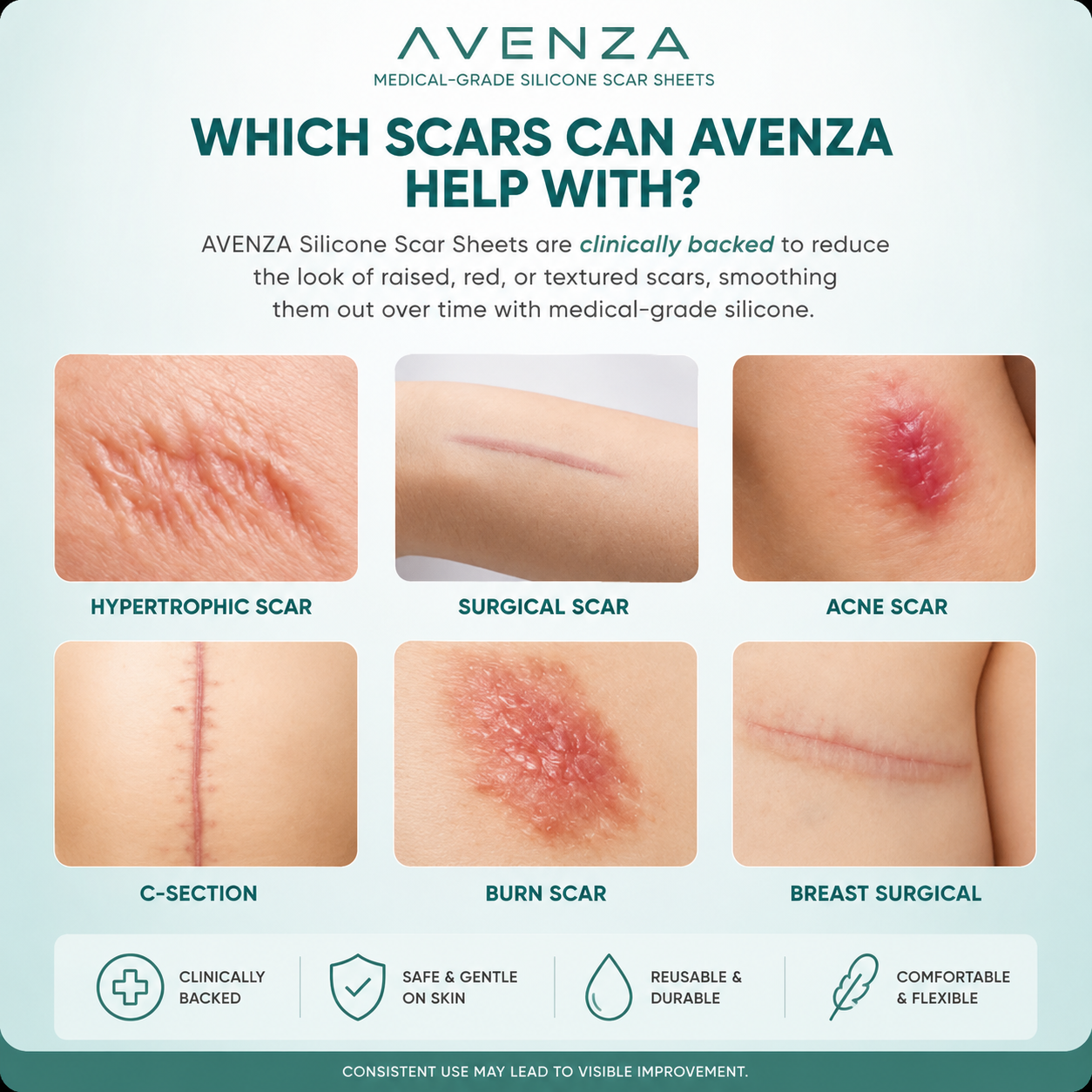 Skinlace™ Smooth Skin Patch